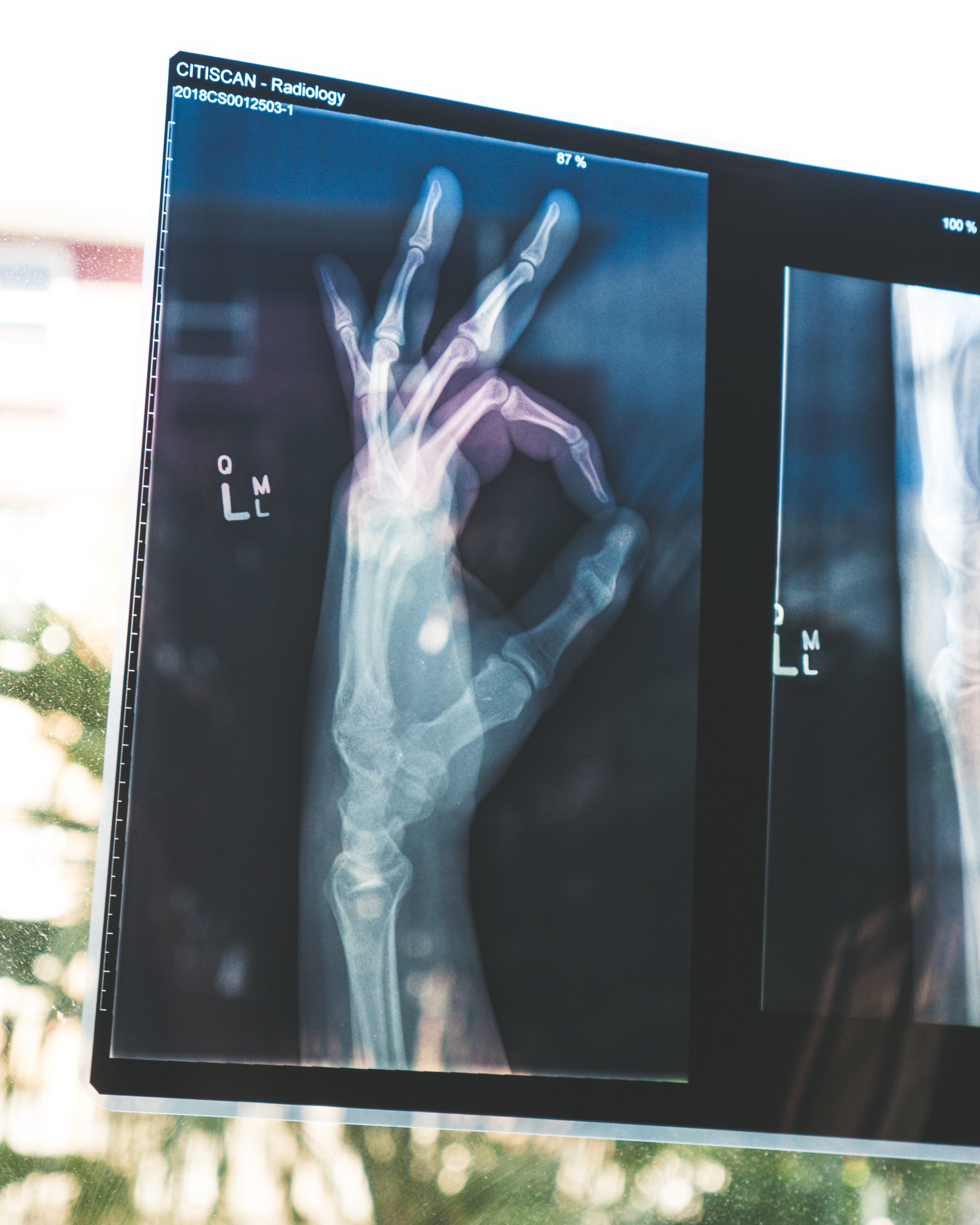 Layanan Radiology